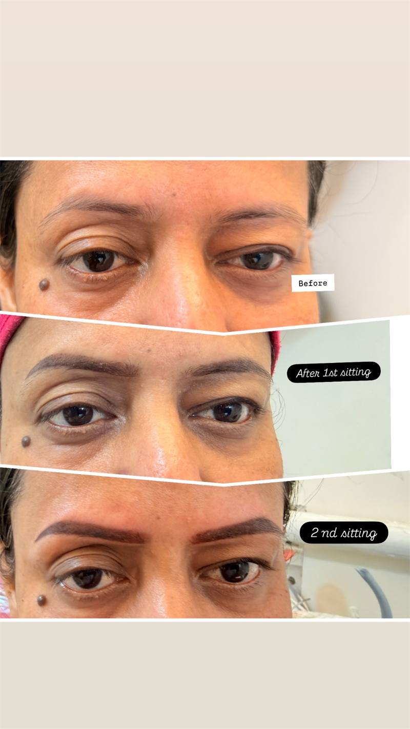 Eyebrow shaping progress across sittings